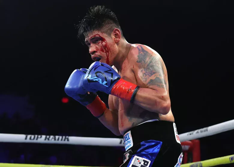 Navarrete vs. Suarez – Injury Caused by Punch, Fight Result Under Review (WBO World Super Featherweight Title out)
納瓦雷特 vs 蘇亞雷斯 —— 傷口由擊打造成，賽果進入重新審查（WBO世界超羽量級拳王戰）